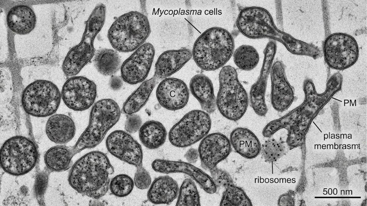 Ảnh chụp kính hiển vi điện tử truyền qua (TEM) của tế bào Mycoplasma đa hình thái
