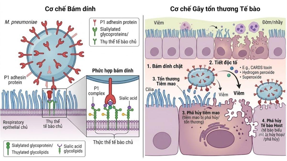 Sơ đồ cơ chế bám dính và gây tổn thương tế bào của protein P1 adhesin