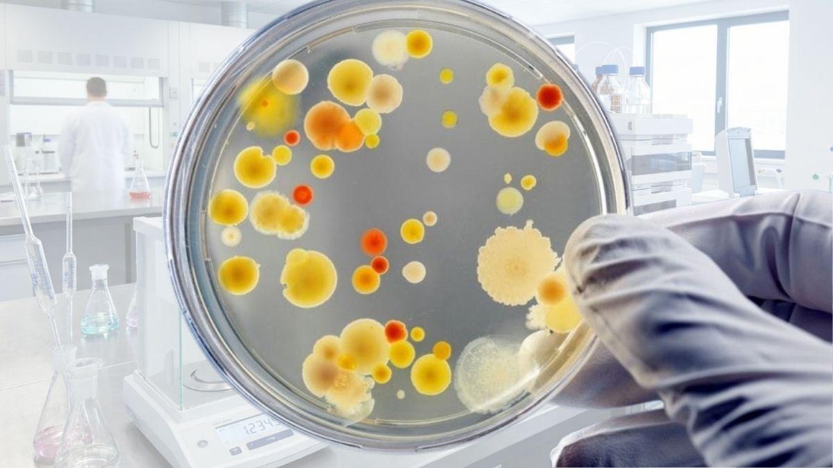 Quan sát các đĩa Petri thạch chứa nhiều khuẩn lạc vi khuẩn đơn lẻ rải rác